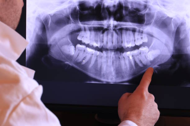 Best Emergency Dental Surgery in Ligh, NE