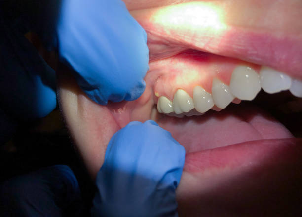 Best Emergency Root Canal Treatment in Ligh, NE